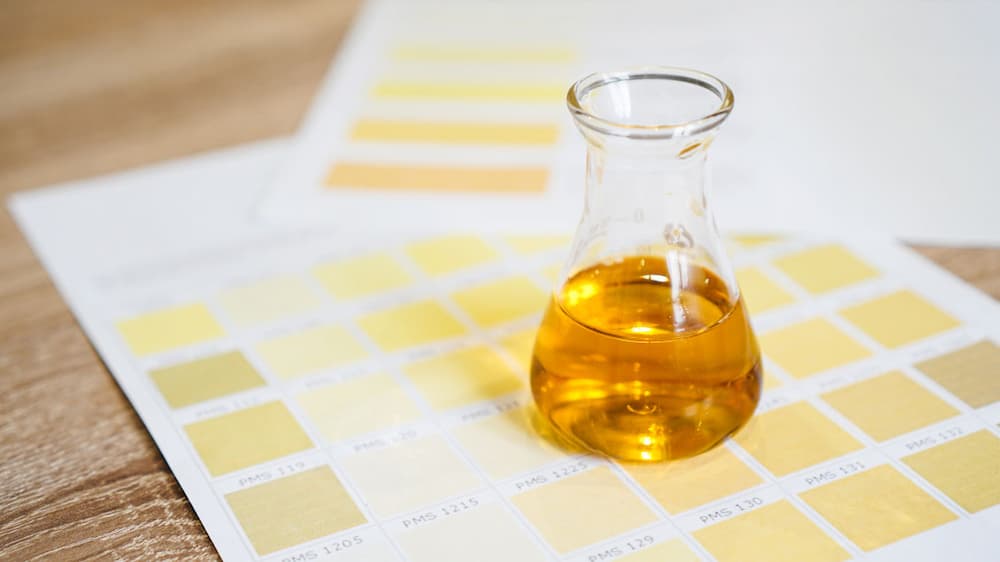 اسباب-اللون-البرتقالى-للحامل