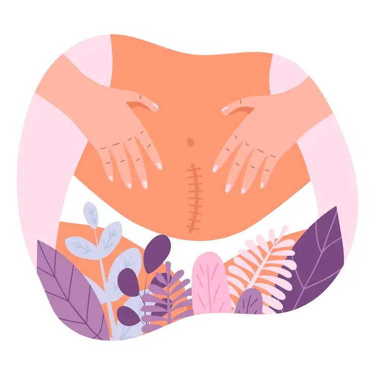 طريقة النوم الصحيحة بعد الولادة القيصرية.. إليك أبرز 3 نقاط 3 طريقة النوم الصحيحة بعد الولادة القيصرية