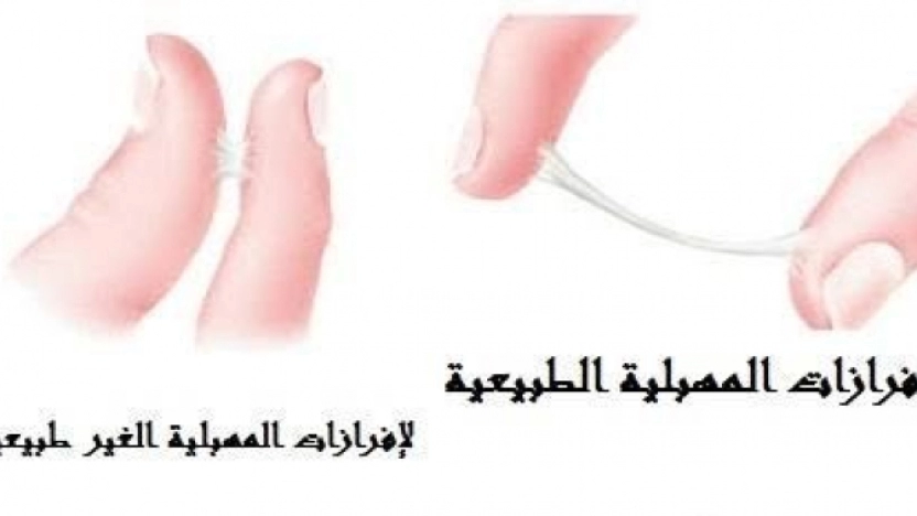إفرازات بيضاء كريمية بالصور 2 هل الافرازات المهبلية طبيعية