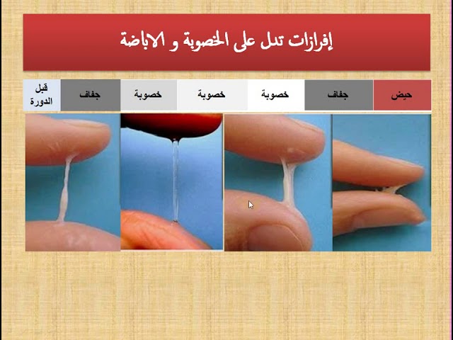 إفرازات بيضاء كريمية بالصور 3 sddefault